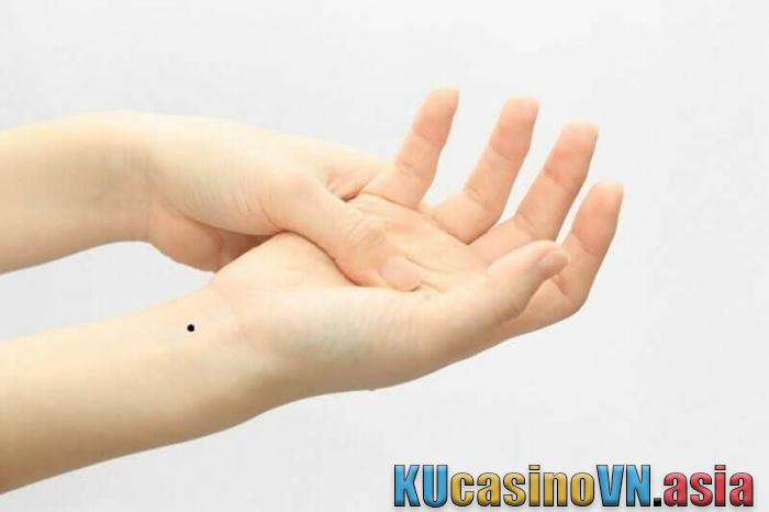 Nốt ruồi ở cổ tay phải