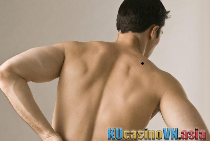 Nốt ruồi ở vai phải