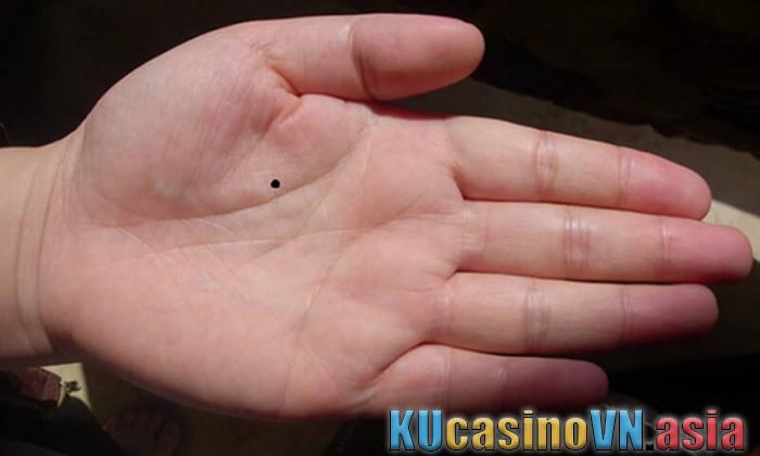 nốt ruồi trong lòng bàn tay trái