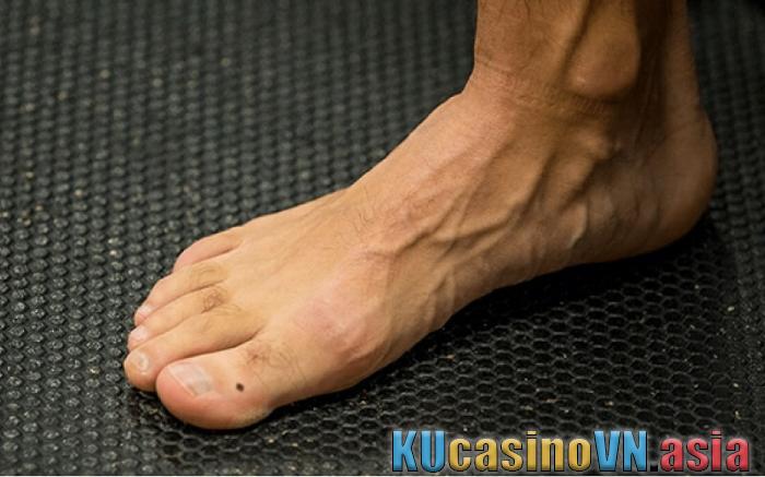 nốt ruồi ở ngón chân cái