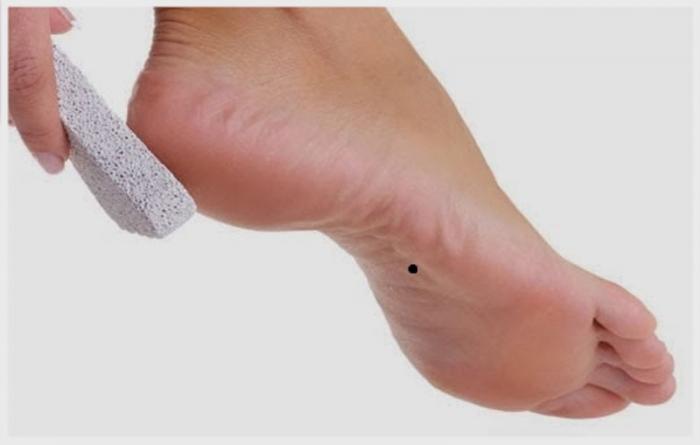 Nốt ruồi ở lòng bàn chân phải có ý nghĩa gì 1571174558