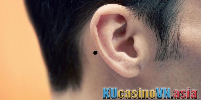 nốt ruồi sau tai