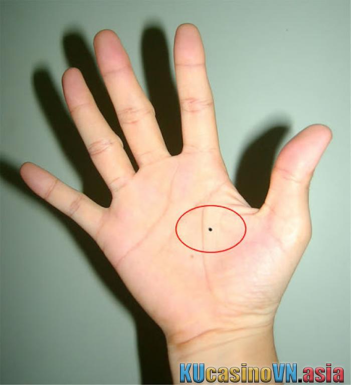 nốt ruồi trong lòng bàn tay phải