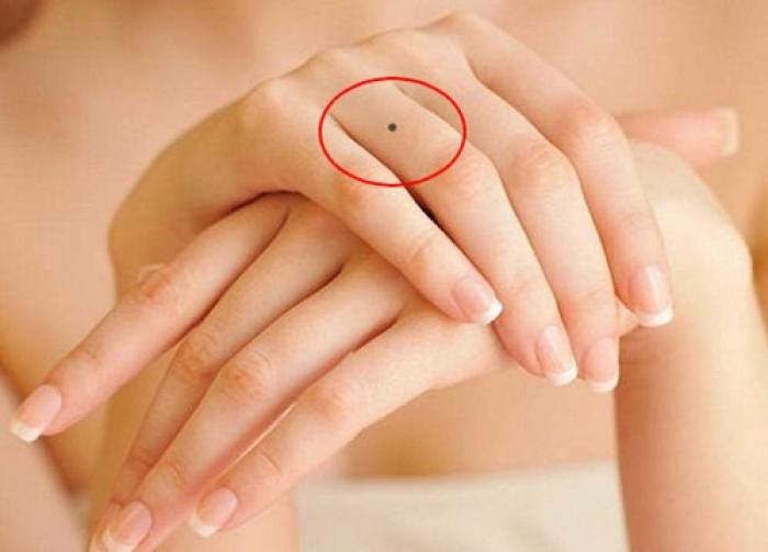 Khám phá ý nghĩa nốt ruồi trên ngón áp út